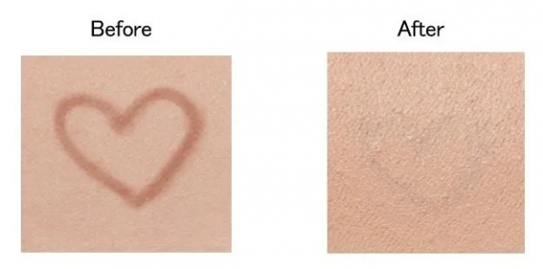 肌のビフォーアフター画像