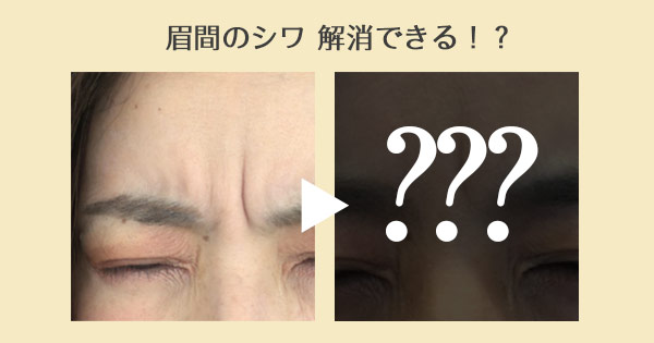 ガチ体験 韓国製ボトックスは効かない 眉間のシワ治療の効果と失敗しない選び方 Jobikai 女美会