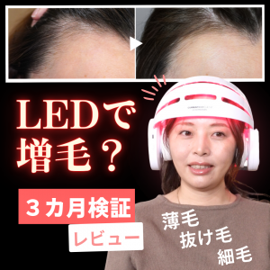 1日10分かぶるだけで薄毛抜け毛改善！？ LED頭皮・頭髪ケア3ヶ月間使用してみた