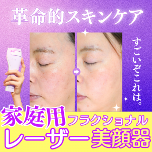 激レア美顔器！家庭用フラクショナルレーザー「トリア スムーズビューティ」の実力を徹底検証！