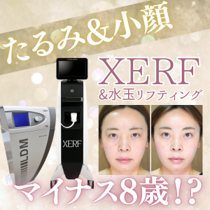 表層から深層まで、たるみと脂肪にアプローチ! XERFの効果を検証!